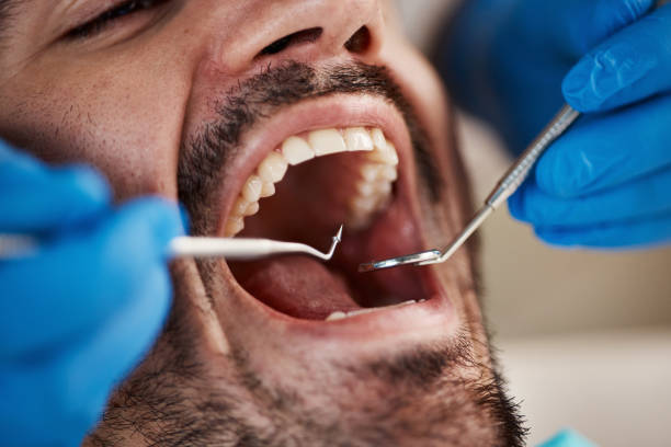 Best Emergency Broken Tooth Repair in Tower Lakes, IL