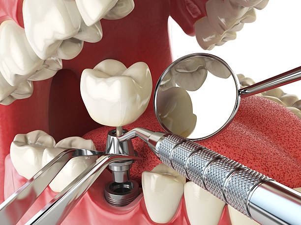 Best 24-Hour Emergency Dentist in Tower Lakes, IL